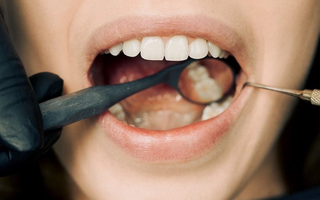 Is Pinhole Gum Rejuvenation Right for You?